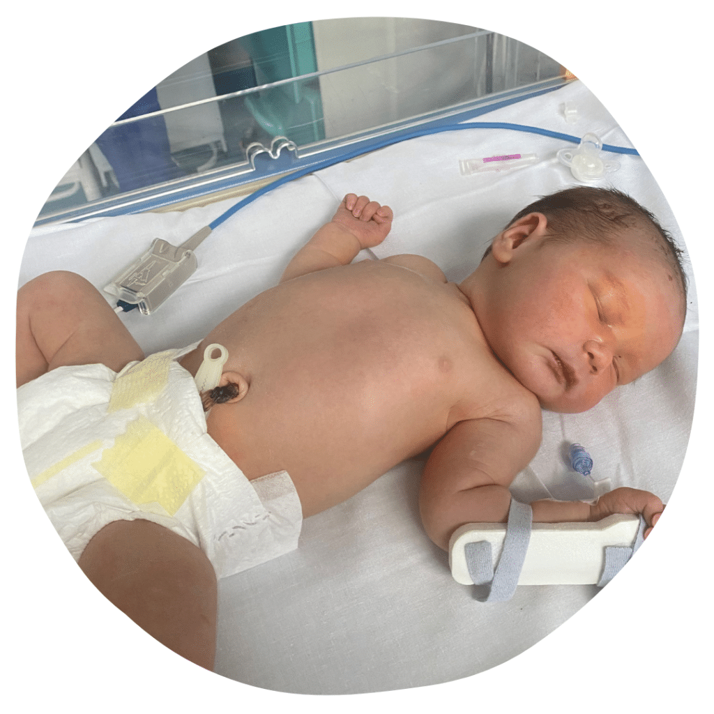 Olivia spent 5 days in the SCBU at North Devon District Hospital.